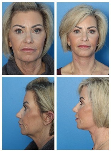 composite_16038904494353