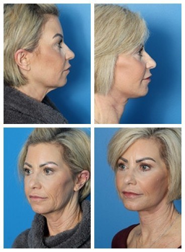 composite_16038904875135