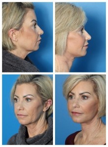 composite_16038904875135