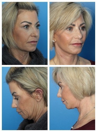 composite_16038905189382