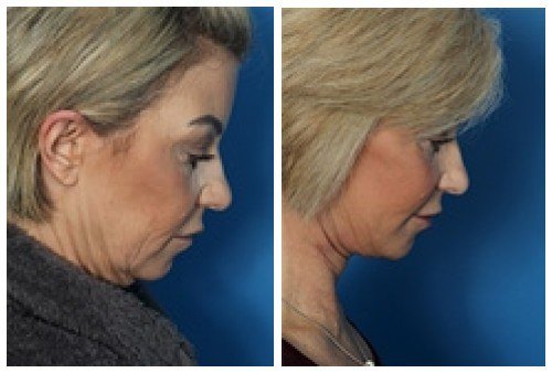 composite_16038906098738