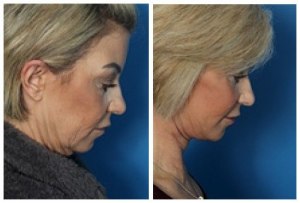 composite_16038906098738