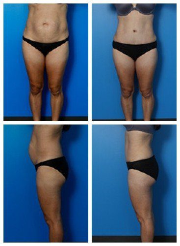 composite_16039704144604