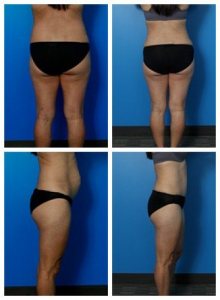 composite_16039704436658