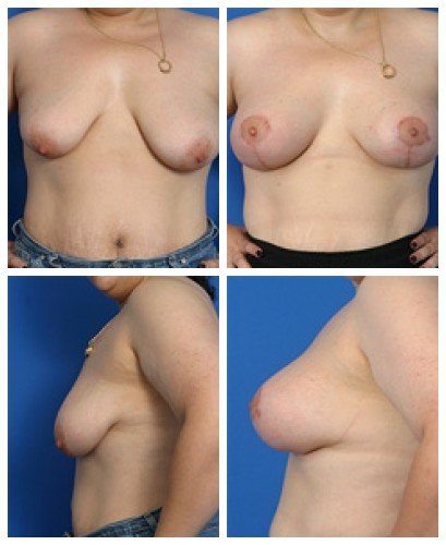 composite_16039784087768