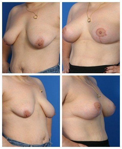 composite_16039784388352