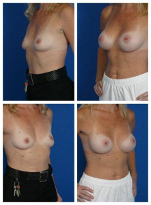 composite_16040462096434