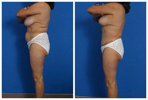 composite_16039595011257