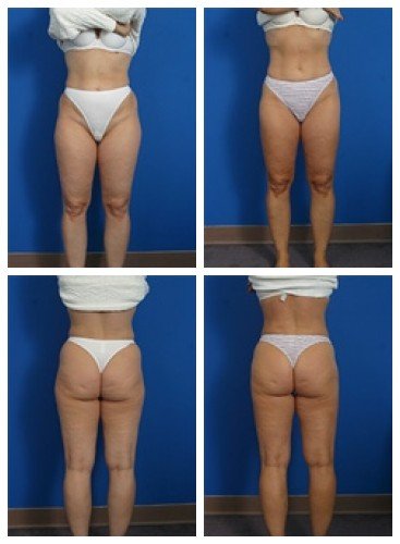 composite_16039624918272