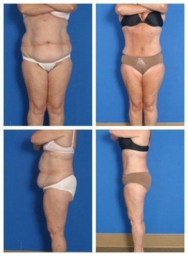 composite_16039704703509