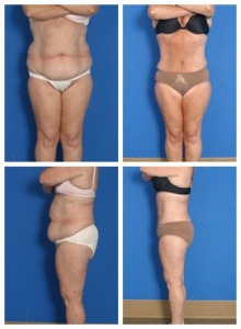 composite_16039704703509