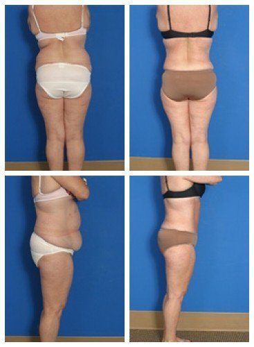 composite_16039705062695