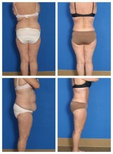 composite_16039705062695