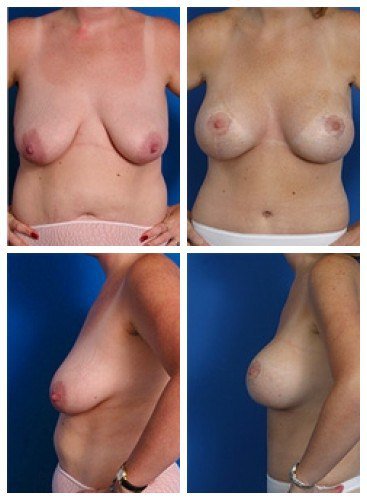 composite_16039784695371