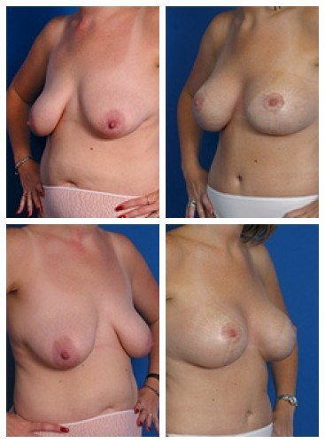 composite_16039785067074