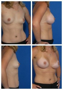 composite_16040462638173