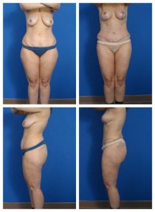 composite_16039596097863