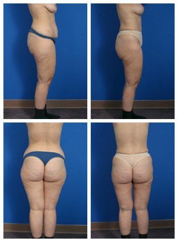 composite_16039597256787