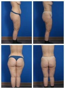 composite_16039597256787