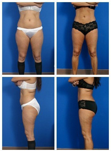 composite_16039625304054