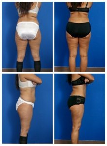 composite_16039625716395