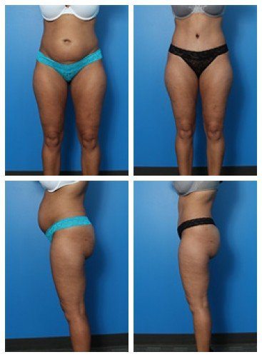 composite_16039705346026