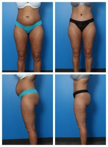 composite_16039705346026