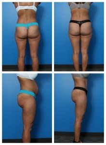 composite_16039705677735