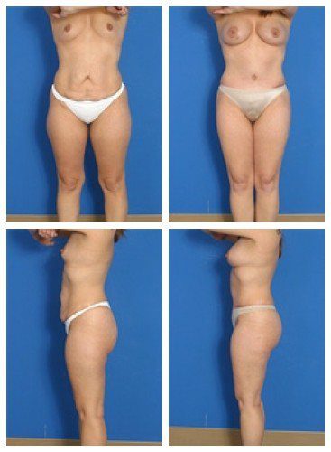 composite_16039602357100