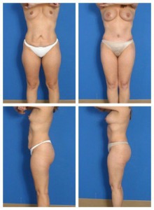 composite_16039602357100