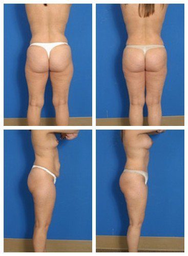 composite_16039602884661