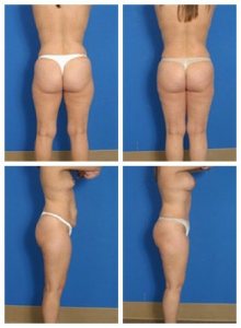 composite_16039602884661