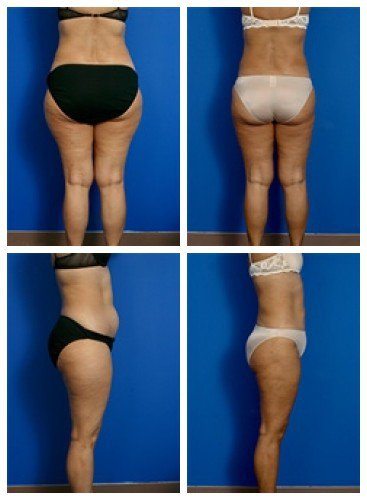 composite_16039626621861