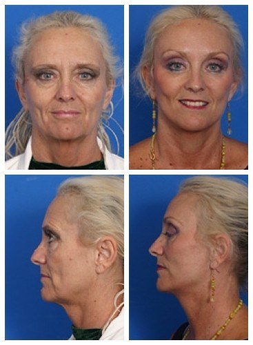 composite_16037108439072