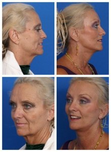 composite_16037176765456