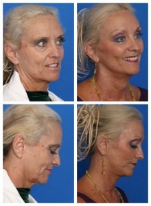 composite_16037225698225