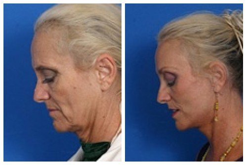 composite_16037227675394