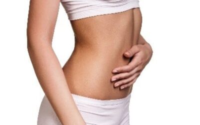 Can Tummy Tuck Help with Stretch Marks?