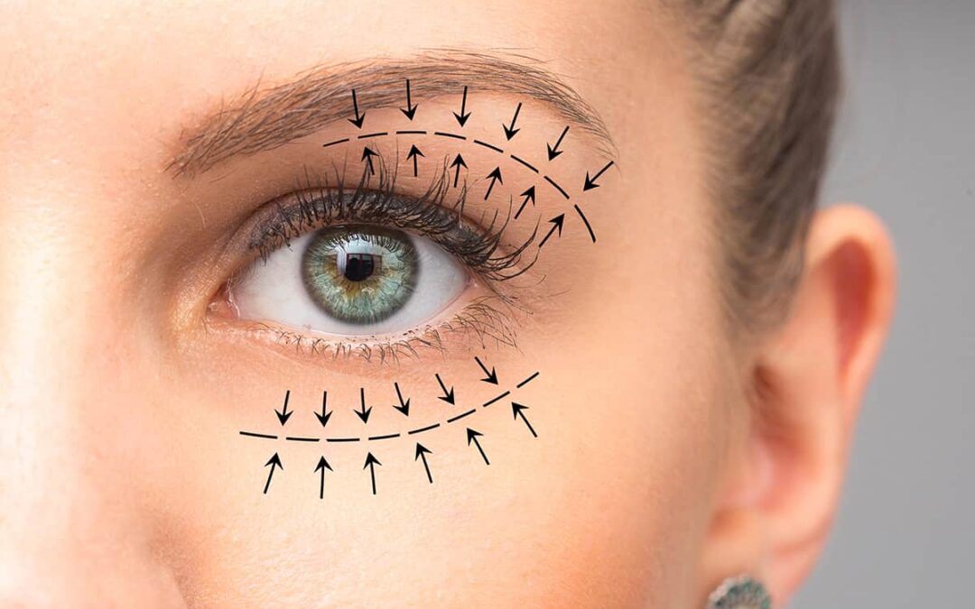 Restore a Young, Rested Appearance with Eyelid Surgery