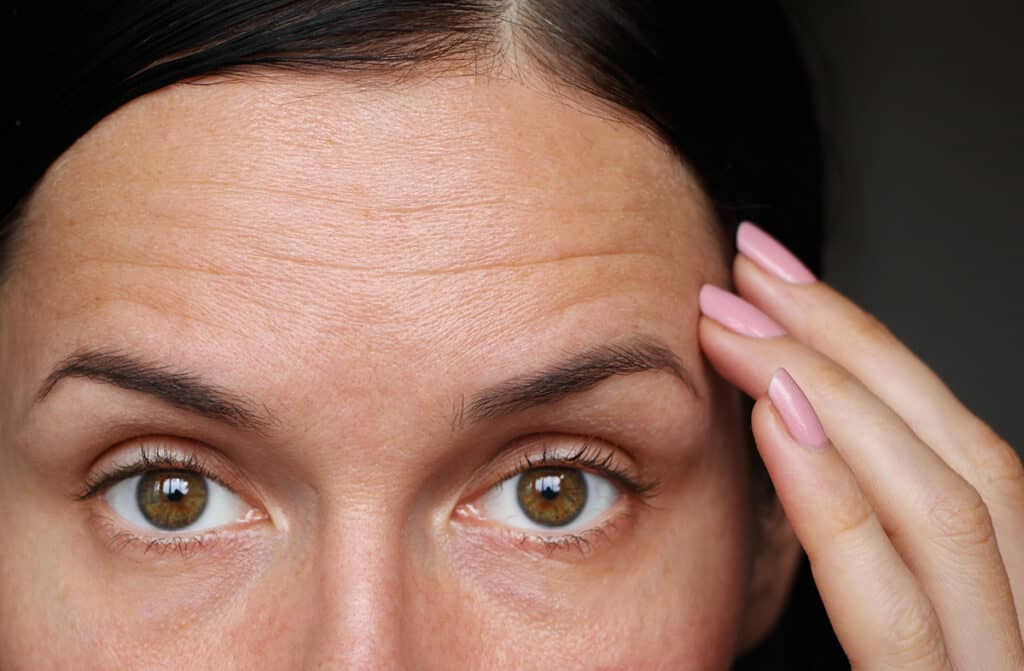 advantages of brow lift surgery
