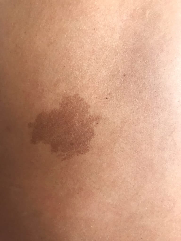 medical tattoo sacramento
