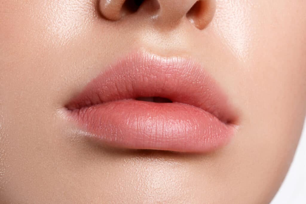 Lip Augmentation results Sacramento 