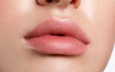 Natural Lip Augmentation Results