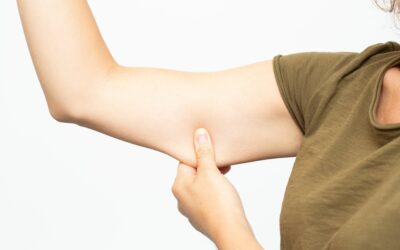 Everything You Need to Know About Arm Liposuction