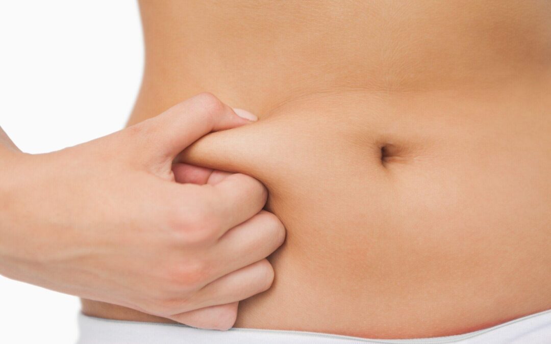 Liposuction vs. Tummy Tuck: Which is Right for You?