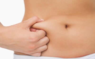 Liposuction vs. Tummy Tuck: Which is Right for You?