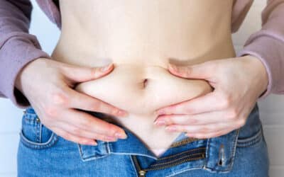 Tummy Tuck Scars: What to Expect and How to Recover Smoothly