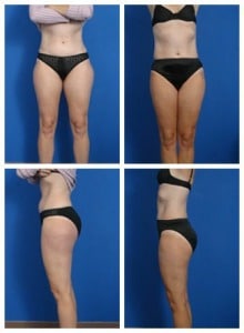 composite_16039620579519.jpg-nggid0232-ngg0dyn-300x300x100-00f0w010c010r110f110r010t010