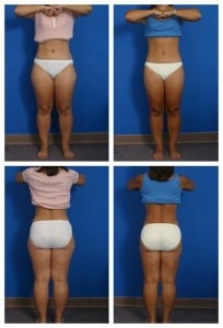 composite_16039621068928.jpg-nggid0234-ngg0dyn-300x300x100-00f0w010c010r110f110r010t010