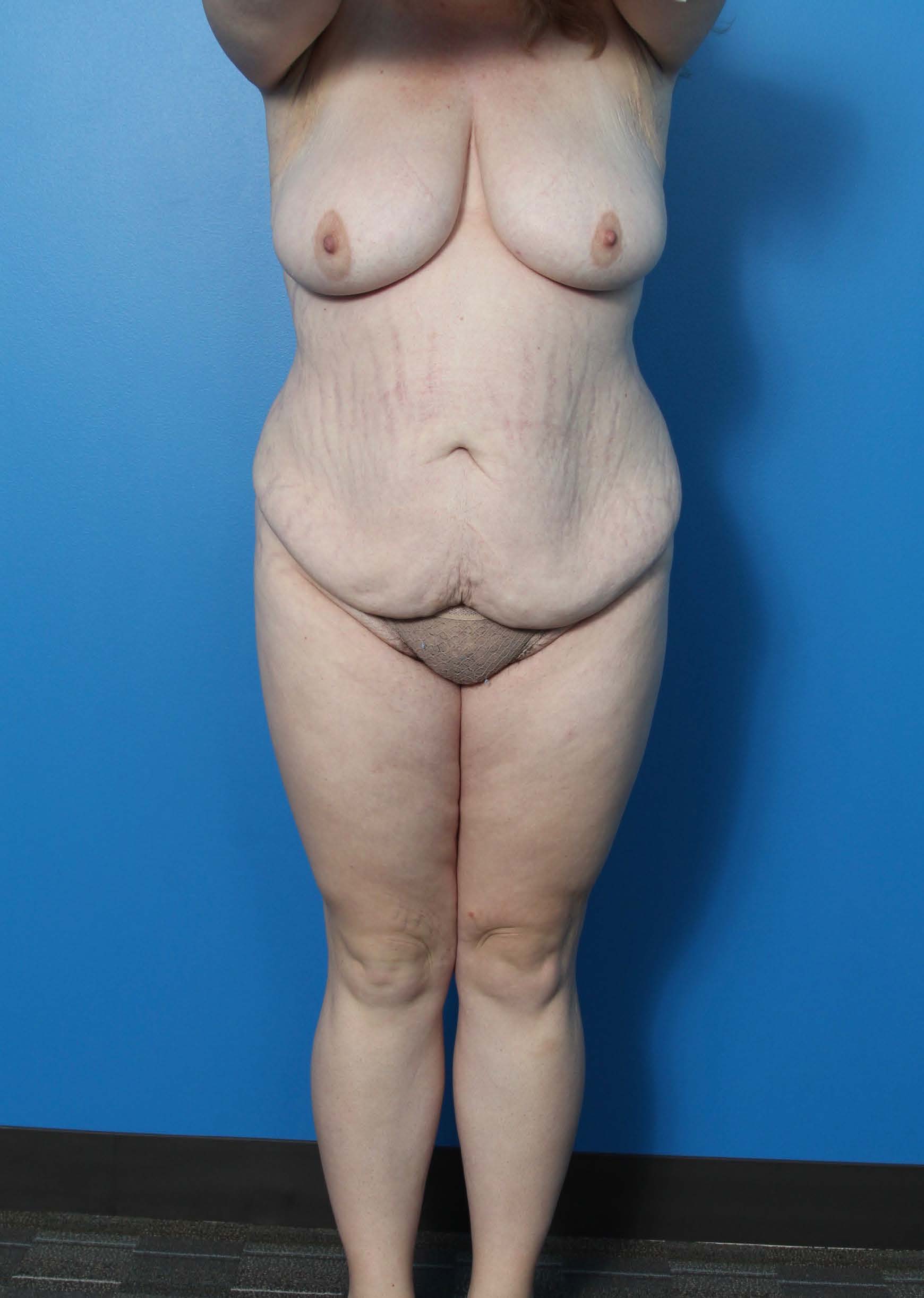 BE MWL 1_Page_1_Image_0001